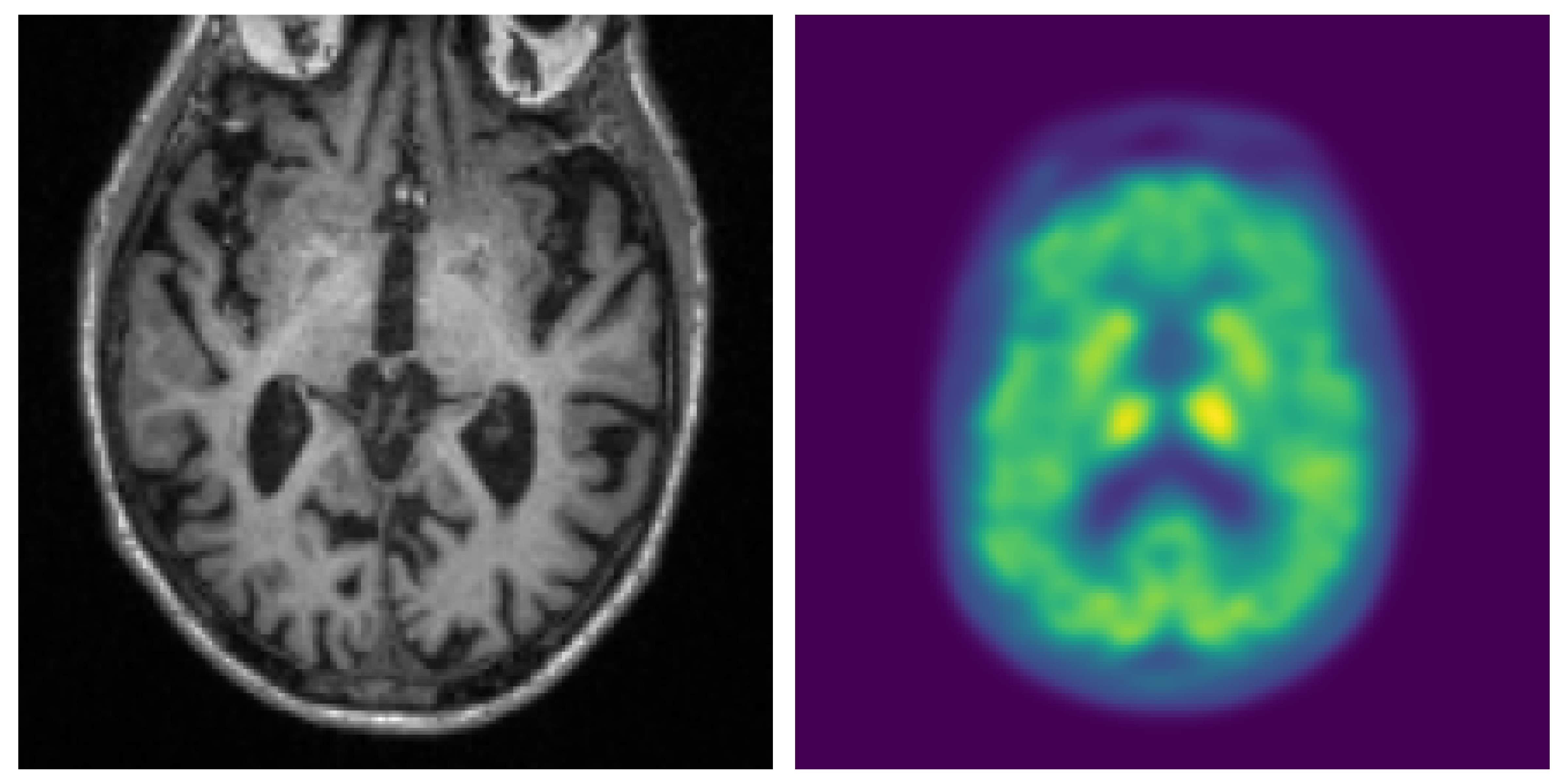 Examples of MRI and PET scans